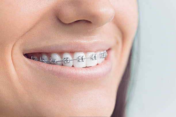 Best Traditional Braces  in Williams, CA